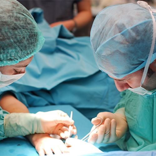 OSTEOARTRİT VE EL